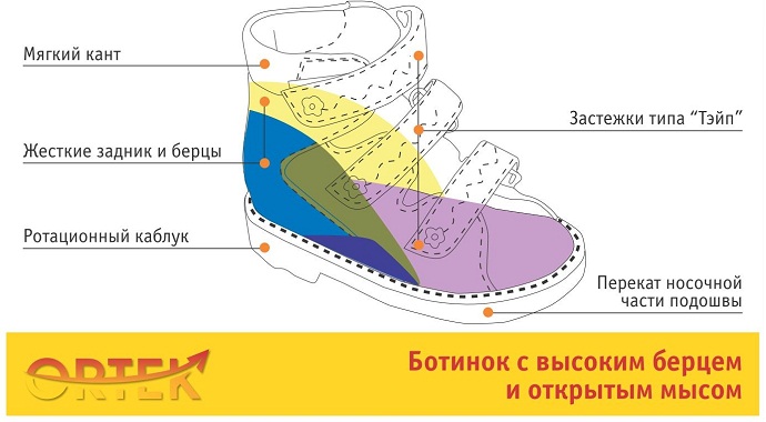 Каблук томаса что это фото